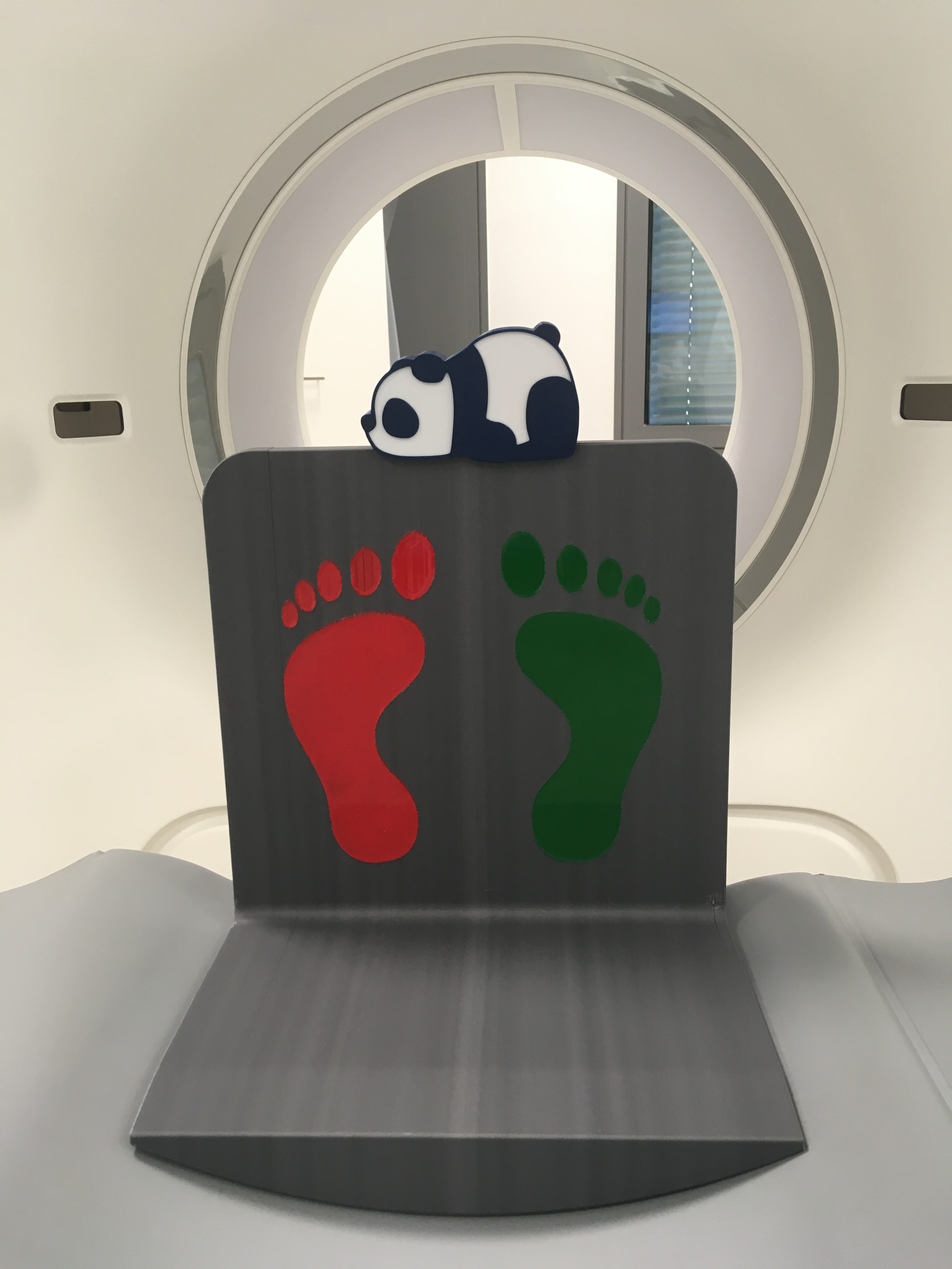 3D printed foot brace- Karolinska University hospital